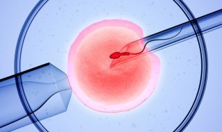 IVF procedure