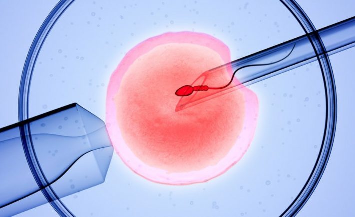 IVF procedure