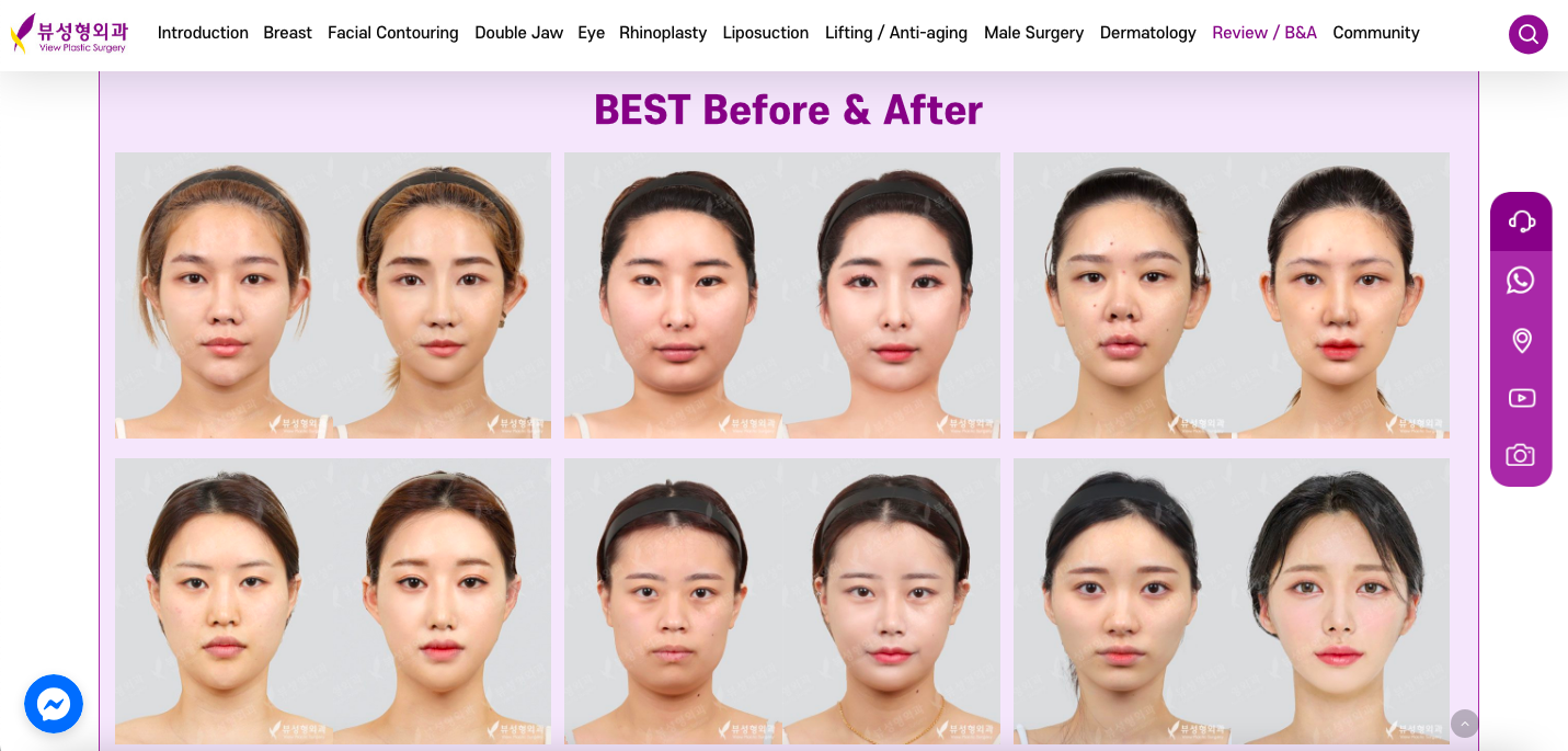 View Plastic Surgery before & after