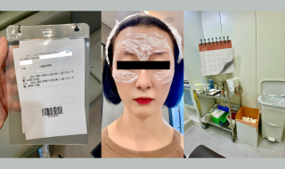 Botox Injections at Lienjang Skin Clinic