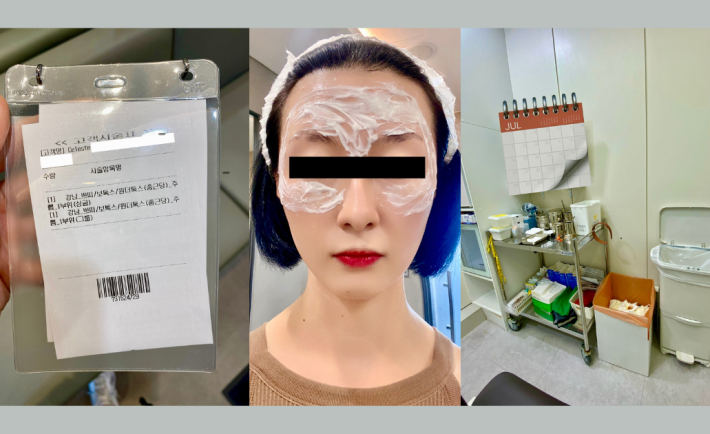 Botox Injections at Lienjang Skin Clinic